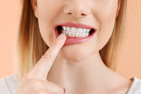 The image shows a woman with her finger on her teeth, looking directly at the camera with an expression of concern or surprise.